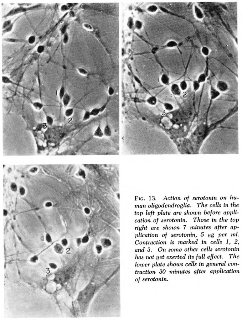 microscopic slides showing brain cells