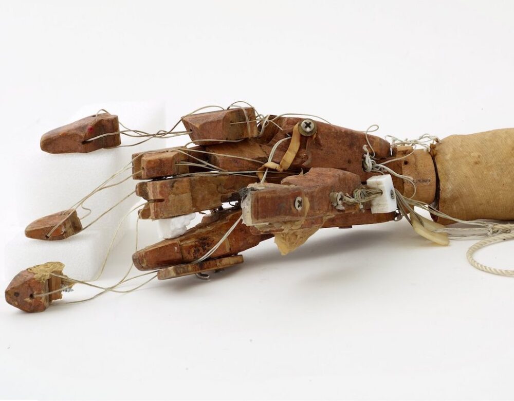 prosthetic arm with strings