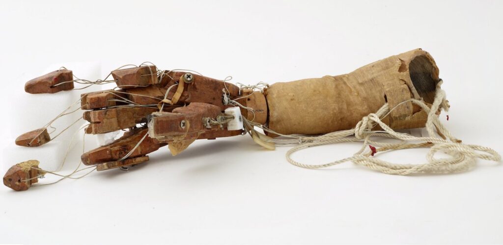 prosthetic arm with strings