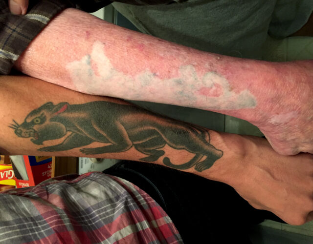 Photograph of the arms of two men. One has a panther tattoo and the other has a scar in the shape of an animal. It looks like a tattoo that has been removed.